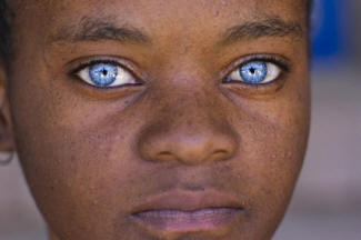 black girl with blue eyes